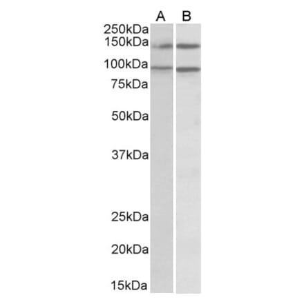 Western Blot - Anti-p114RhoGEF Antibody (A82796) - Antibodies.com