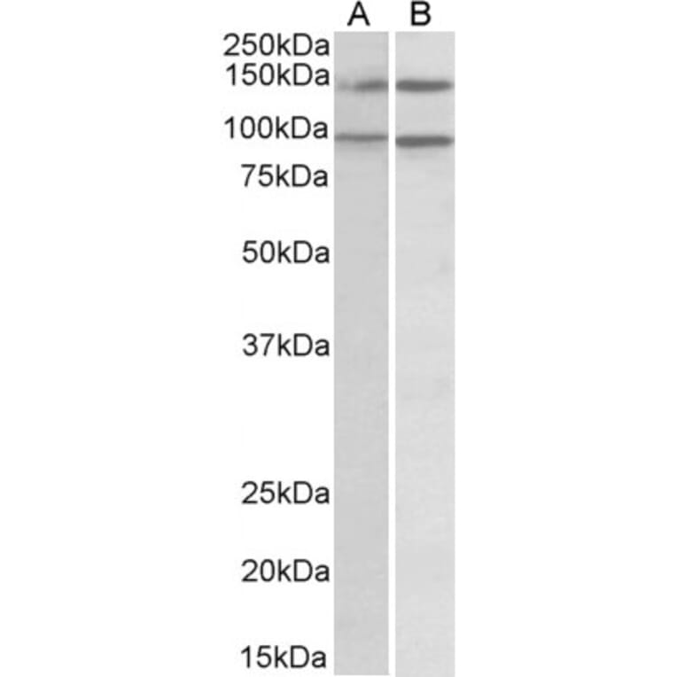 Western Blot - Anti-p114RhoGEF Antibody (A82796) - Antibodies.com