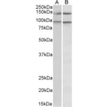 Western Blot - Anti-p114RhoGEF Antibody (A82796) - Antibodies.com