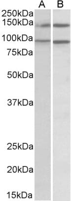 Anti-ARHGEF18 Antibody (A82796) (0.5µg/ml) staining of lysates of cell lines Daudi (A) and Caco-2 (B) (35µg protein in RIPA buffer). Primary incubation was 1 hour. Detected by chemiluminescence.