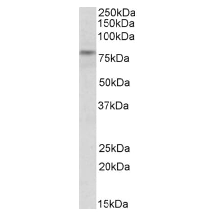 Western Blot - Anti-TRIM2 Antibody (A82797) - Antibodies.com