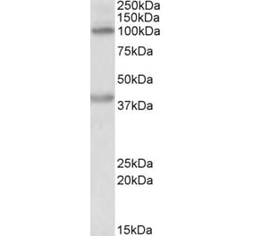 Western Blot - Anti-ZEB2 Antibody (A82799) - Antibodies.com