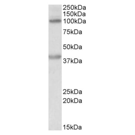 Western Blot - Anti-ZEB2 Antibody (A82799) - Antibodies.com