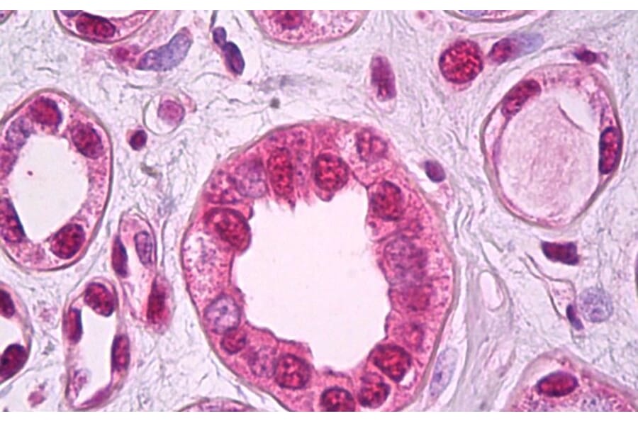 Immunohistochemistry - Anti-ZEB2 Antibody (A82799) - Antibodies.com
