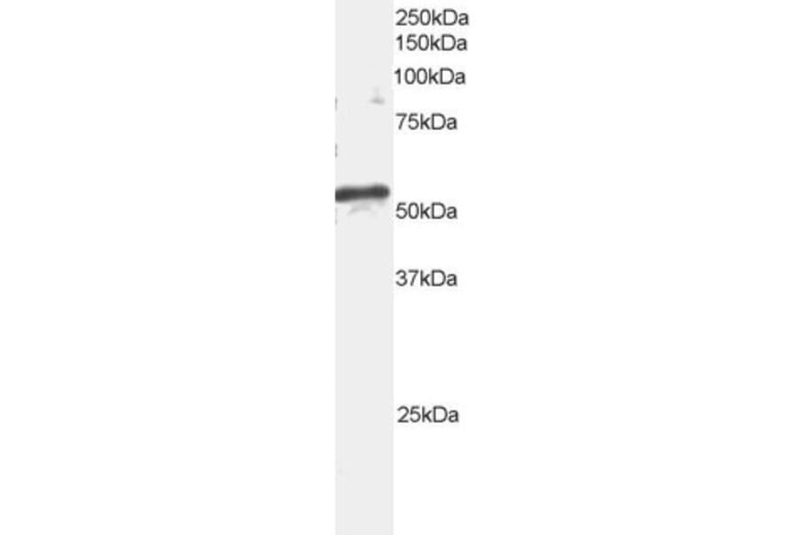 Western Blot - Anti-ARFGAP1 Antibody (A82800) - Antibodies.com