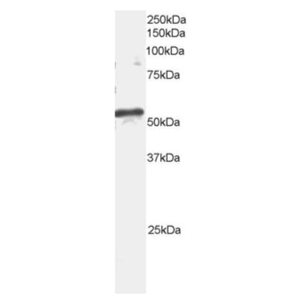 Western Blot - Anti-ARFGAP1 Antibody (A82800) - Antibodies.com