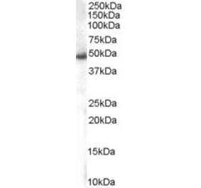 Western Blot - Anti-SNX5 Antibody (A82802) - Antibodies.com