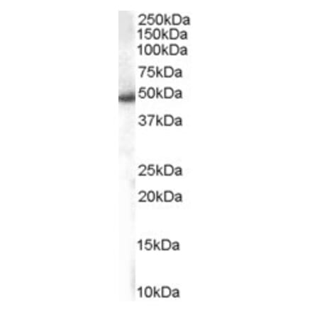 Western Blot - Anti-SNX5 Antibody (A82802) - Antibodies.com