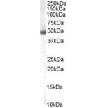 Western Blot - Anti-SNX5 Antibody (A82802) - Antibodies.com