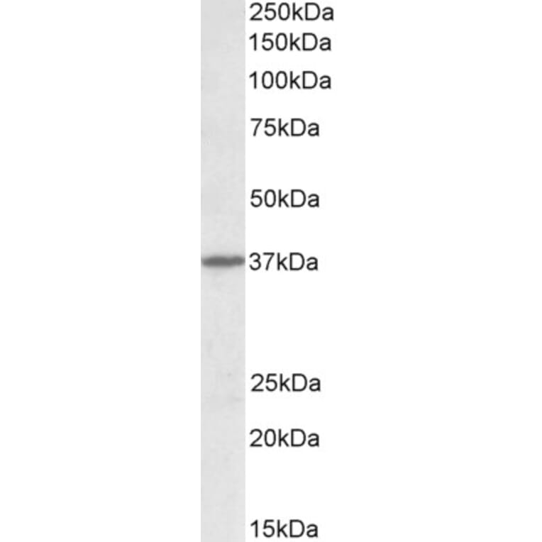 Western Blot - Anti-SynCAM/CADM1 Antibody (A82805) - Antibodies.com