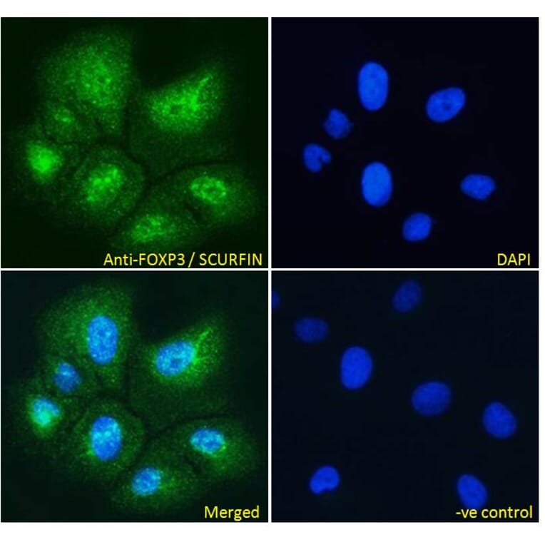 Immunofluorescence - Anti-FOXP3 Antibody (A82808) - Antibodies.com