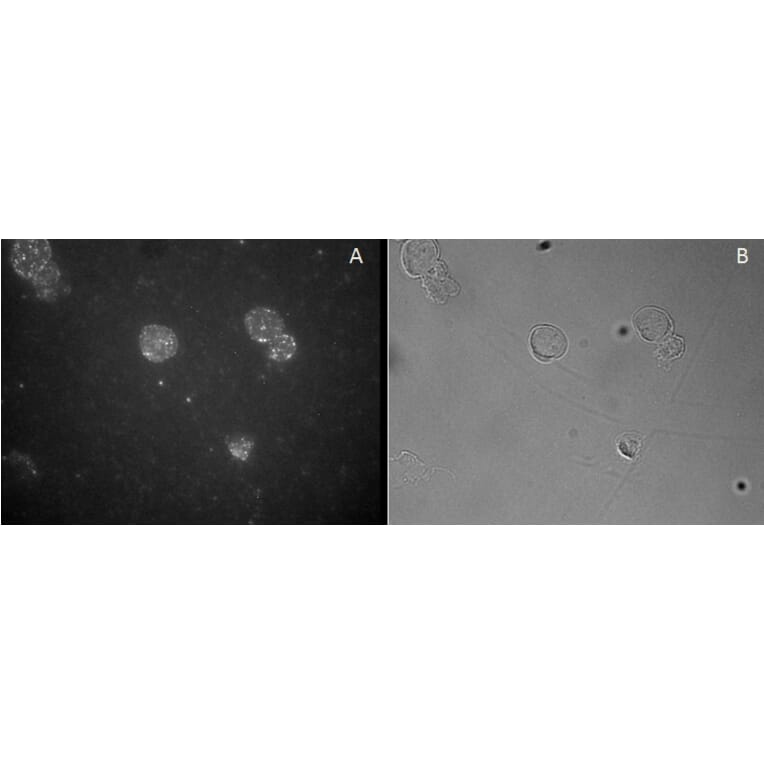 Immunofluorescence - Anti-FOXP3 Antibody (A82808) - Antibodies.com