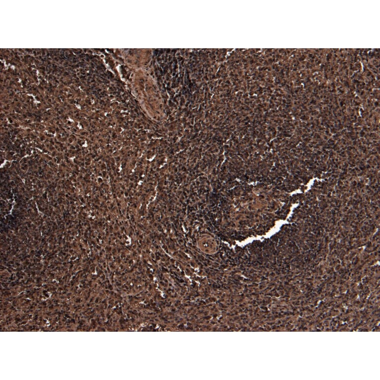 Immunohistochemistry - Anti-FOXP3 Antibody (A82808) - Antibodies.com