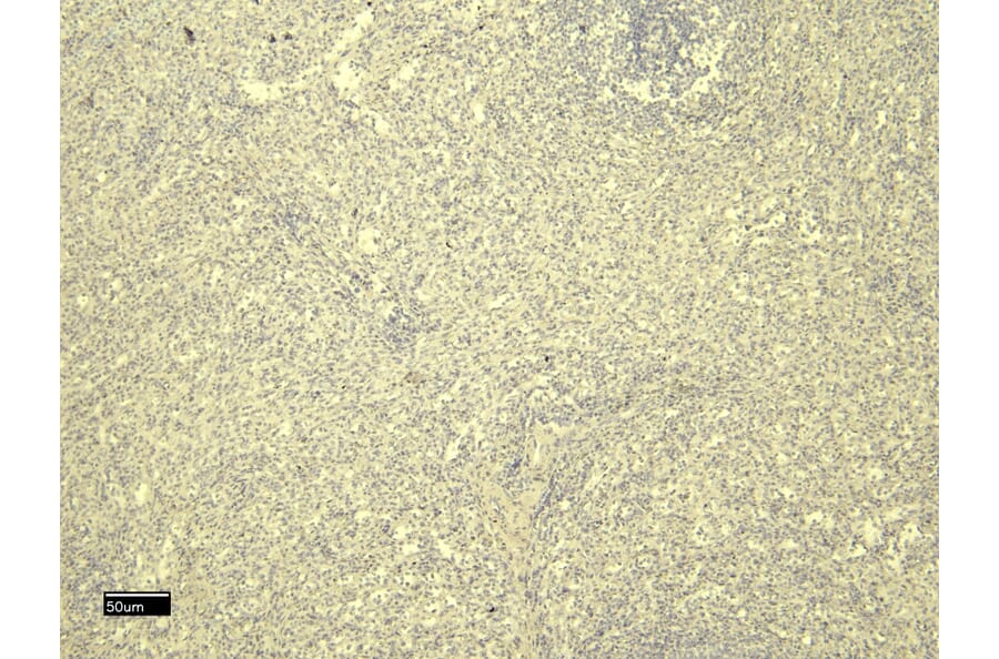 Immunohistochemistry - Anti-FOXP3 Antibody (A82808) - Antibodies.com