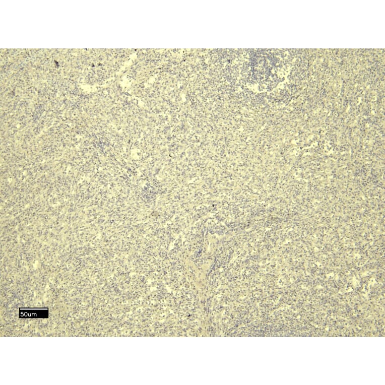 Immunohistochemistry - Anti-FOXP3 Antibody (A82808) - Antibodies.com