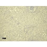 Immunohistochemistry - Anti-FOXP3 Antibody (A82808) - Antibodies.com
