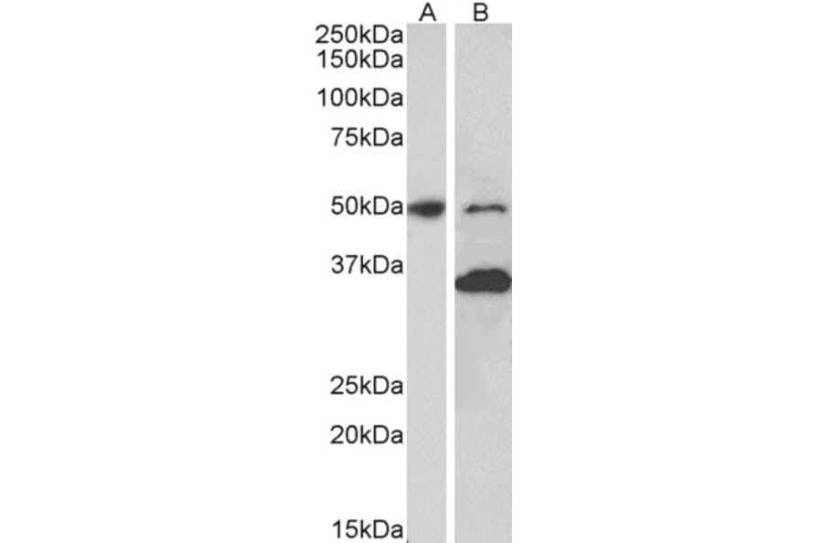 Western Blot - Anti-MKRN1 Antibody (A82810) - Antibodies.com