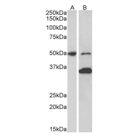 Western Blot - Anti-MKRN1 Antibody (A82810) - Antibodies.com