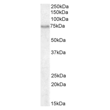 Western Blot - Anti-BLNK Antibody (A82812) - Antibodies.com