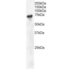 Western Blot - Anti-BLNK Antibody (A82812) - Antibodies.com