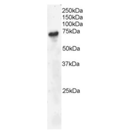 Western Blot - Anti-BLNK Antibody (A82812) - Antibodies.com