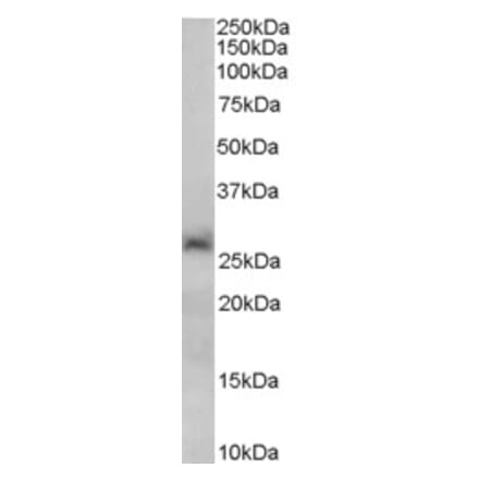 Western Blot - Anti-SIRT3 Antibody (A82814) - Antibodies.com