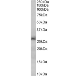 Western Blot - Anti-SIRT3 Antibody (A82814) - Antibodies.com