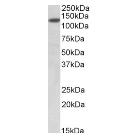 Western Blot - Anti-SIRT1 Antibody (A82815) - Antibodies.com