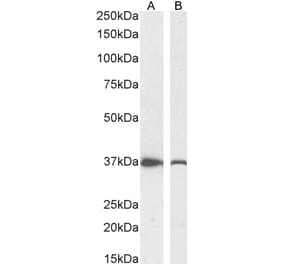 Western Blot - Anti-DDAH1 Antibody (A82817) - Antibodies.com