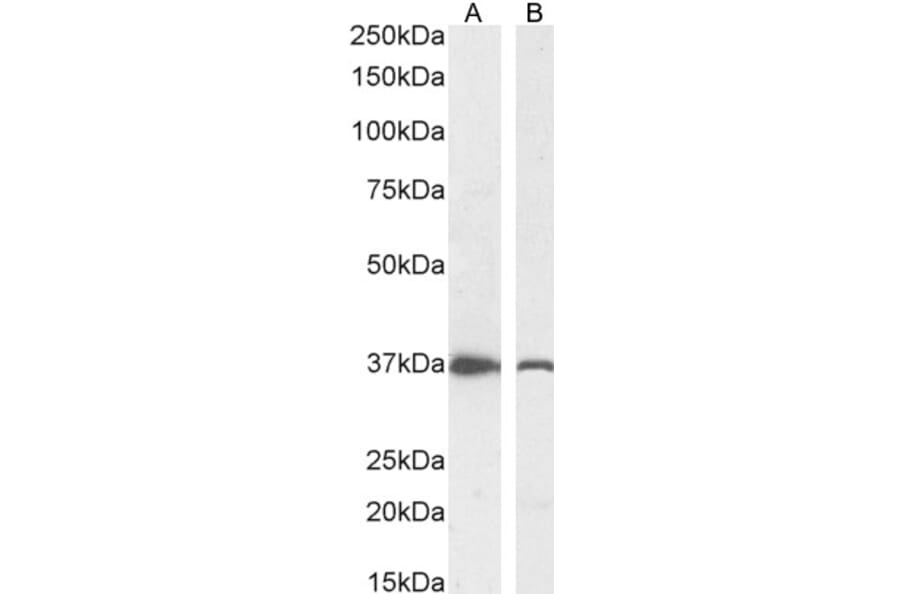 Western Blot - Anti-DDAH1 Antibody (A82817) - Antibodies.com