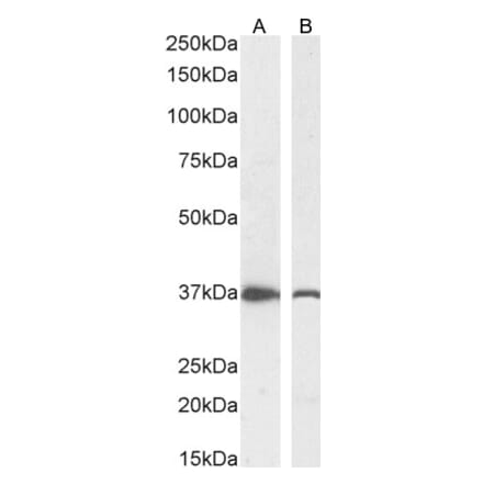 Western Blot - Anti-DDAH1 Antibody (A82817) - Antibodies.com