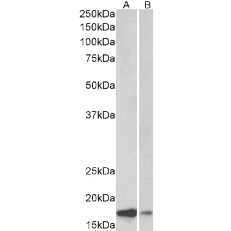 Western Blot - Anti-alpha Synuclein Antibody (A82818) - Antibodies.com