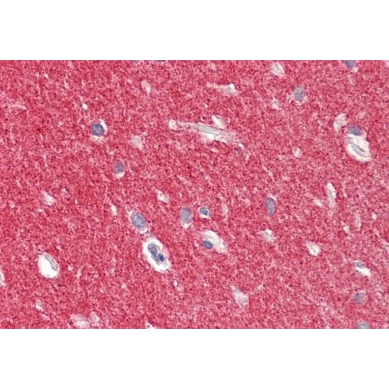 Immunohistochemistry - Anti-alpha Synuclein Antibody (A82818) - Antibodies.com