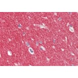 Immunohistochemistry - Anti-alpha Synuclein Antibody (A82818) - Antibodies.com