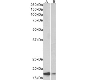 Western Blot - Anti-alpha Synuclein Antibody (A82818)