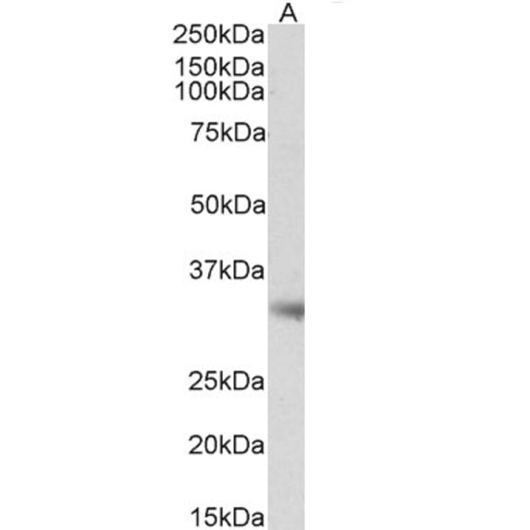 Western Blot - Anti-Monoacylglycerol Lipase/MGL Antibody (A82819) - Antibodies.com