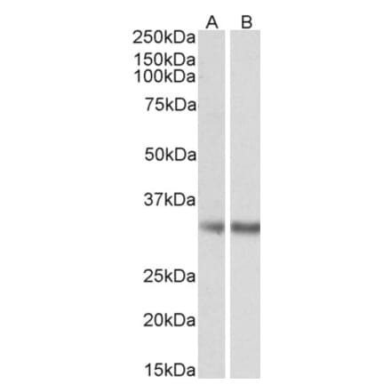 Western Blot - Anti-MGLL Antibody (A82819) - Antibodies.com