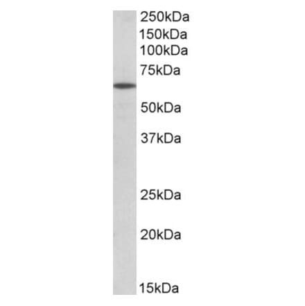 Western Blot - Anti-POU6F2 Antibody (A82820) - Antibodies.com