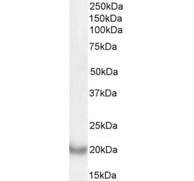 Western Blot - Anti-DCTN3 Antibody (A82821) - Antibodies.com