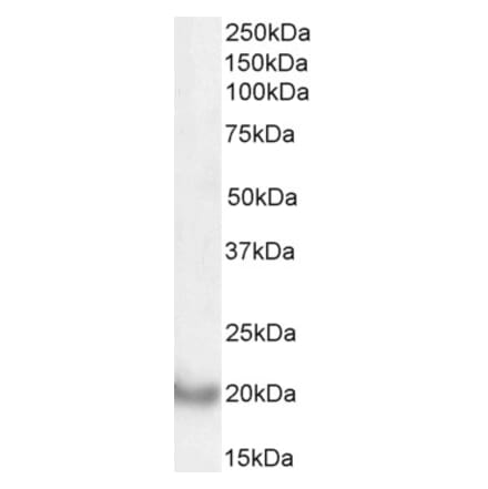 Western Blot - Anti-DCTN3 Antibody (A82821) - Antibodies.com