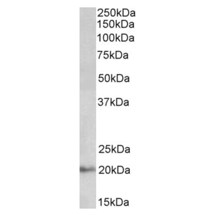 Western Blot - Anti-DCTN3 Antibody (A82821) - Antibodies.com