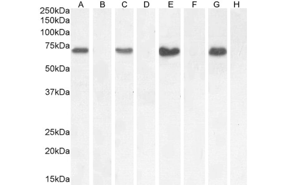 Western Blot - Anti-NOX1 Antibody (A82822) - Antibodies.com