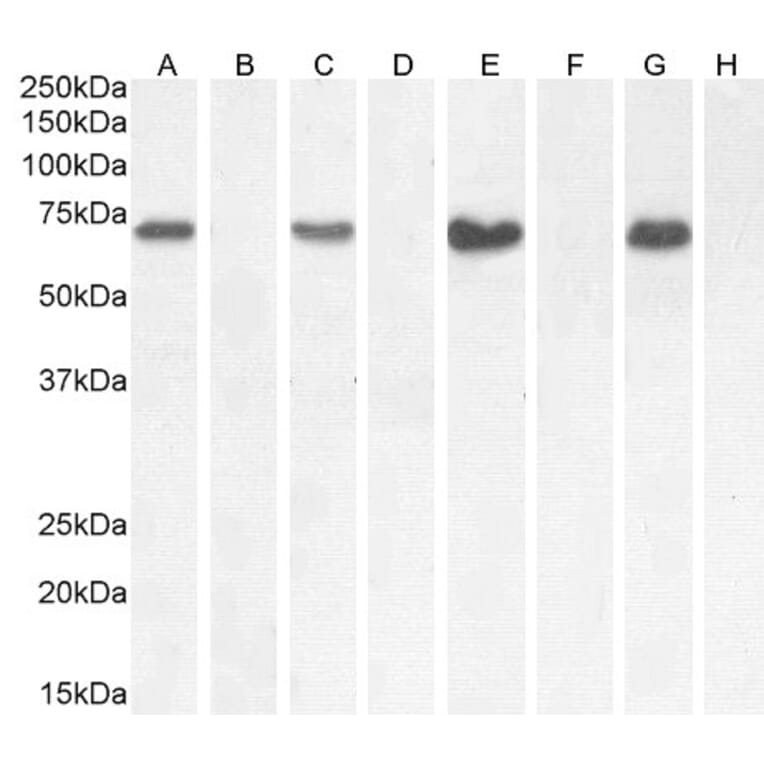 Western Blot - Anti-NOX1 Antibody (A82822) - Antibodies.com