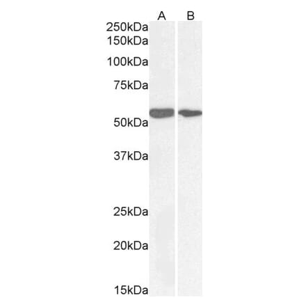 Western Blot - Anti-NOX1 Antibody (A82822) - Antibodies.com