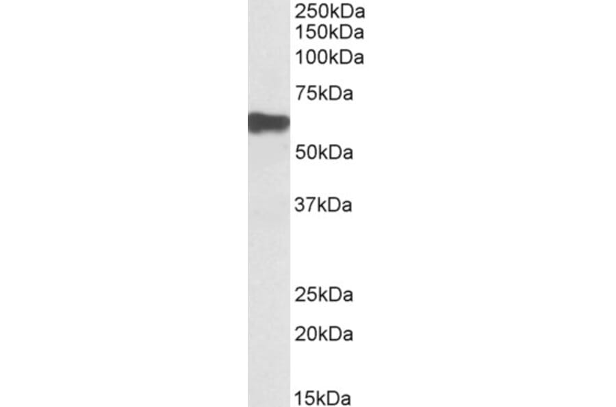 Western Blot - Anti-Myotilin Antibody (A82823) - Antibodies.com