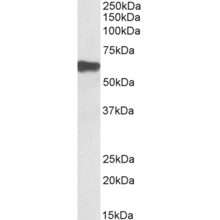 Western Blot - Anti-Myotilin Antibody (A82823) - Antibodies.com