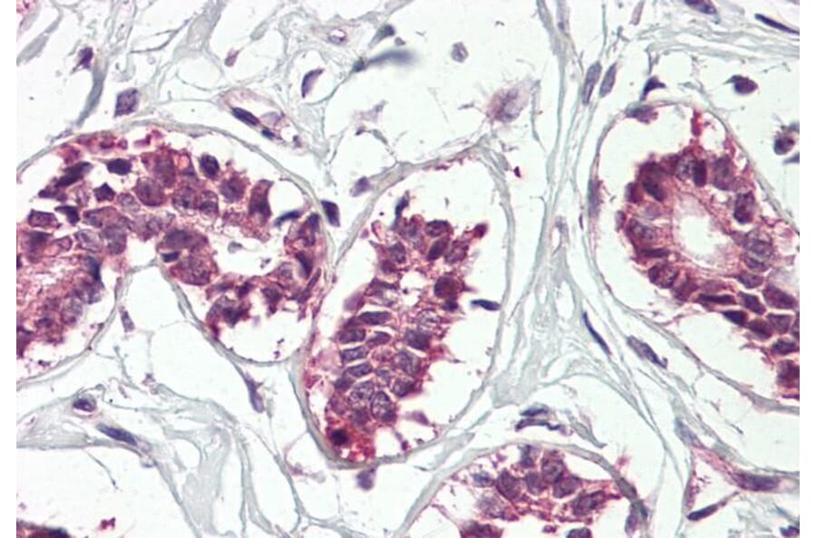 Immunohistochemistry - Anti-IGF2BP1/IMP1 Antibody (A82824) - Antibodies.com