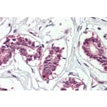 Immunohistochemistry - Anti-IGF2BP1/IMP1 Antibody (A82824) - Antibodies.com