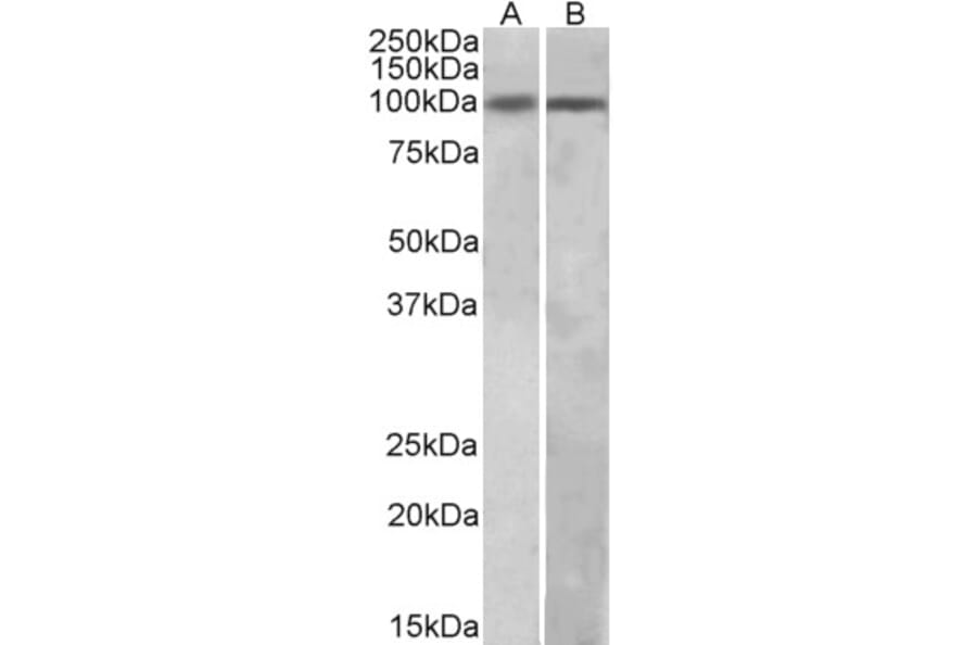 Western Blot - Anti-HIC1 Antibody (A82825) - Antibodies.com