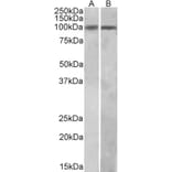 Western Blot - Anti-HIC1 Antibody (A82825) - Antibodies.com